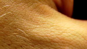 Náhrada ľudskej kože už existuje. Je recyklovateľná a dokáže sa zahojiť