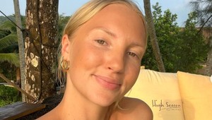 Žena prezradila, ako sa zbavila vrások: Verte mi, ide to aj bez botoxu!