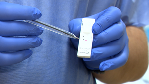 Veľká sláva alebo hanba? Toto si myslia odborníci o plošnom testovaní