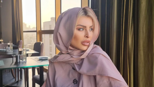 Príšerný pohľad na Lelu Vémolu po zákroku! Pre hejterov má ostrý odkaz!