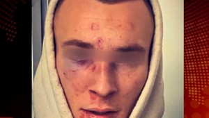 Obeťou útoku v centre Bratislavy sa stal aj Adam (19). Jeho matka opísala, ako k bitke malo dôjsť