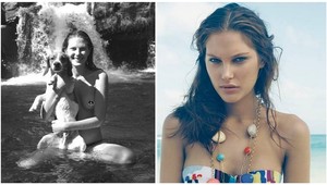 Modelka Catherine McNeil (25) bojuje za slobodu bradaviek, ukazuje ich kde môže