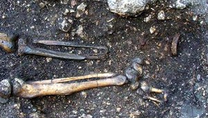 Archeológovia v Rakúsku našli najstaršiu európsku protézu. Patrila mužovi