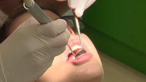 Vedeli ste, že poistení majú nárok na ošetrenie zubného kazu zadarmo? To však funguje len papieri