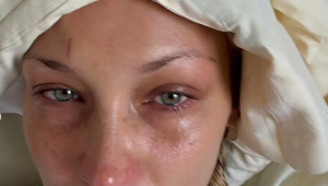 Z nemocničného lôžka na Instagram: Topmodelka odhaľuje svoje najhoršie chvíle!