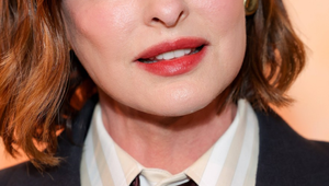 NAVŽDY znetvorená: Slávna topmodelka sa nedokáže na seba viac pozrieť