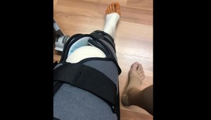 Nešťastný pád slovenskej herečky na lyžovačke!