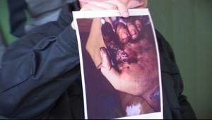 Pri útoku nožom odsekli študentovi ruku