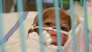 Podpaľačom rómskeho domu hrozí doživotie