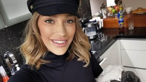 Epidémia napichaných pier? Podľahla už aj Jasmina. FOTO v článku