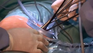 Operujú v 35 stupňových horúčavách. Zabrať dostáva personál aj pacienti