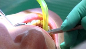 Ján (44) pri návšteve zubára zažil šok. Na zubnú náhradu si má počkať do augusta 2021