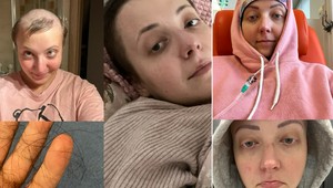 Anička Slováčková bojuje s rakovinou: Jej dni sú však spočítané