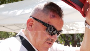 V garáži rodinného domu napadli starostu obce a člena strany Hlas-SD