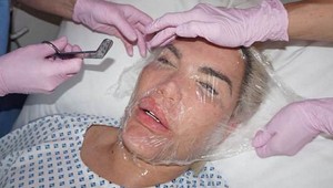 Znetvorili ste ma, zlostí sa Ken po zákroku v Prahe