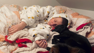 Česká speváčka ukázala FOTO po chemoterapii: Kašlať na vlasy...