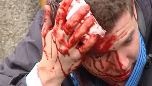 Namiesto futbalu krvavý ring!