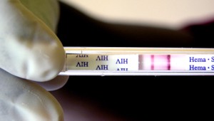 Vírus HIV podľa vedcov stráca silu a je menej infekčný