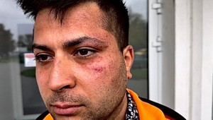 Facky, kopance či slová o zastrelení parazita. Mladík tvrdí, že ho zmlátili policajti