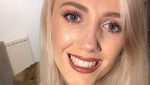 Bez mejkapu sa neodvážila ani vyniesť odpadky: TAKTO si poradila so silným akné