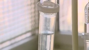 Žltačka typu A si vyžiadala už 19 životov. Za rok sa nakazilo viac ako 500 ľudí