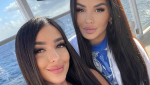 Plačkovej najlepšia kamarátka na ňu vytiahla spoločnú FOTO pred plastikami: Wau, krása sa za peniaze dá kúpiť!