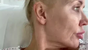 Britku trápil “morčací krk,” podstúpila zákrok v Čechách: Pozrite sa, ako teraz vyzerá jej tvár!