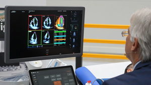 Prelom v zdravotníctve: Lekárom pri diagnostike bude pomáhať umelá inteligencia