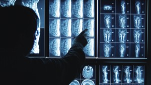 Dvetisíc ľudí je bez lekára. V dvoch obciach ordinuje jeden