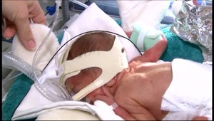 Záchranný set pomôže deťom hneď po porodení