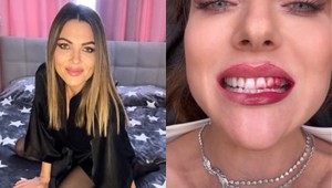 Martina Schindlerová šokovala KRVAVÝM úsmevom: Fanúšikovia sa zľakli, čo sa jej stalo!