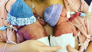 Nedávali im žiadnu šancu na prežitie: Takto vyzerajú najmenšie dvojčatá Británie dnes