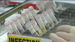 Vedec pracoval na štúdii pre ministerstvo zdravotníctva. Keď negatívne zistenia zverejnil, zatkli ho