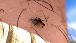 Už len krok nás delí od vakcíny na lymskú boreliózu