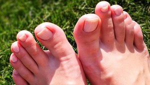 Máte ustavične studené nohy? Toto môžu byť dôvody