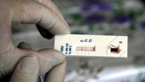 Život s HIV je dlhší a kvalitnejší. Aj vďaka disciplíne pacientov