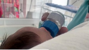 Seboroidná dermatitída nie je alergia: Mastné červené šupiny trápia najmä mužov