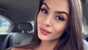 Popálená youtuberka Týnuš ukázala zjazvenú tvár bez mejkapu filtrov: Nemám sa za čo hanbiť!