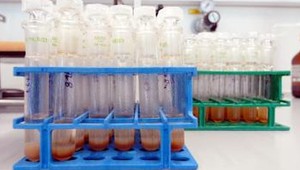 Opätovné analýzy odhalili ďalších 45 pozitívnych z OH