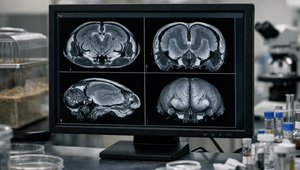 Mobil a rakovina? Verdikt po rokoch