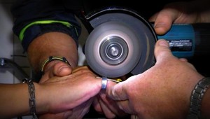 Kuriózny zásah hasičov. Odstraňovali prsteň z malíčka