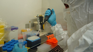 Nebezpečné ochorenie na Slovensku: Vedci a hygienici zachytili nový vírus