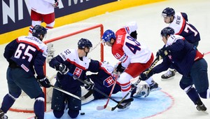 MS 2025: Hertl neposilní Čechov, trápia ho problémy s ramenom