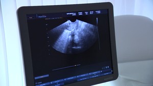 Po sprísnení interrupcií prišla v Poľsku o život ďalšia tehotná žena