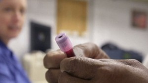 TIETO 3 faktory spôsobujú až polovicu úmrtí na rakovinu: Odstrániť ich môže každý!