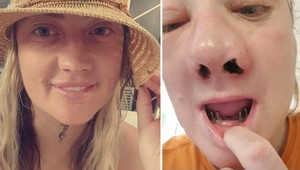 Chcela hollywoodsky úsmev, teraz zažíva muky: Nemá zuby, ale horšie je TOTO!