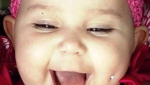 Matka zverejnila fotku svojej dcérky s pírsingom v líci. Jej zámer prekvapil