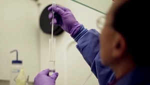 Vedci sú opäť o krok bližšie k liečeniu Alzheimerovej choroby. Vyvinuli nový experimentálny liek