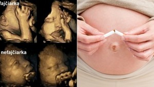 Šokujúci dôkaz: Toto spôsobuje FAJČENIE bábätkám v brušku!
