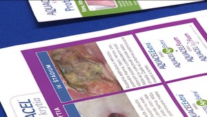 Dekubity môžu postihnúť človeka v každom veku. Ako sa pred nimi chrániť?